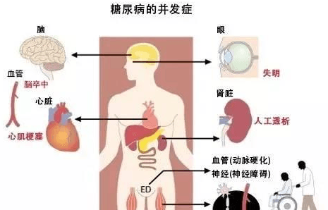 负离子