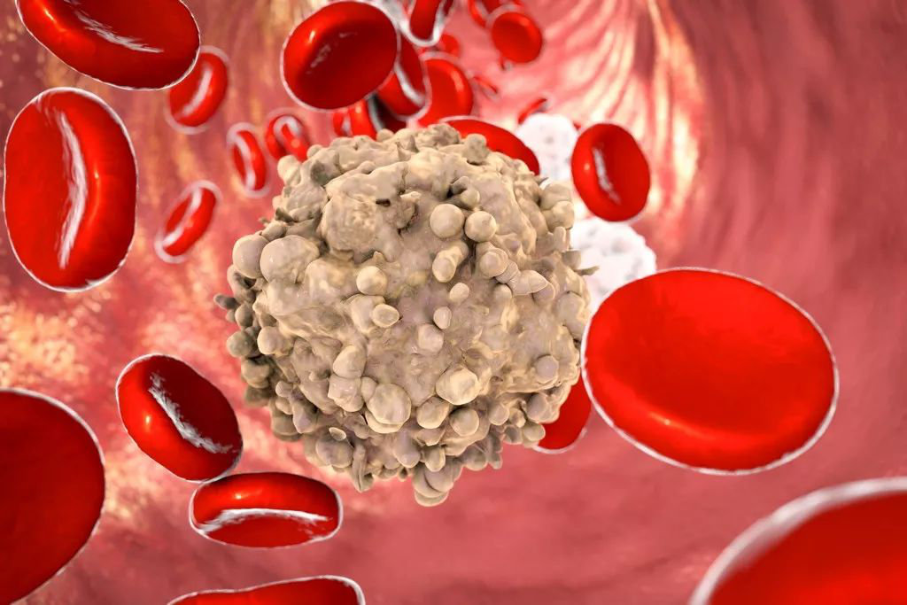 白血病“血癌”并非绝症，专家论证：负氧离子可有效防治白血病