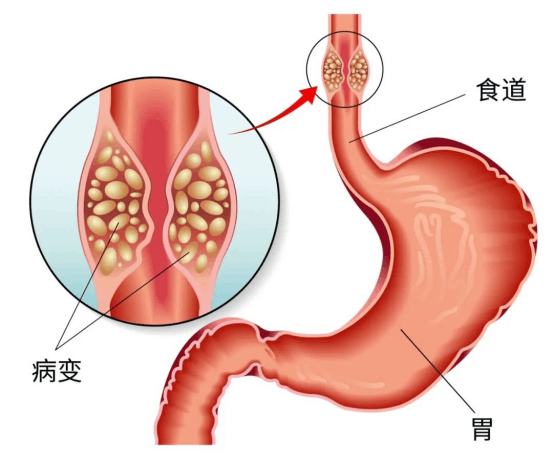 夏资强11 22任务一649